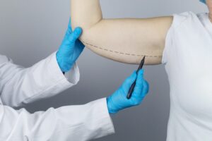 Top Tips for a Smooth Arm Lift Recovery_ Timeline and Expert Advice Featured