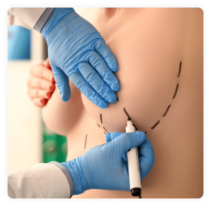 Top Plastic Surgeons USA|Breast