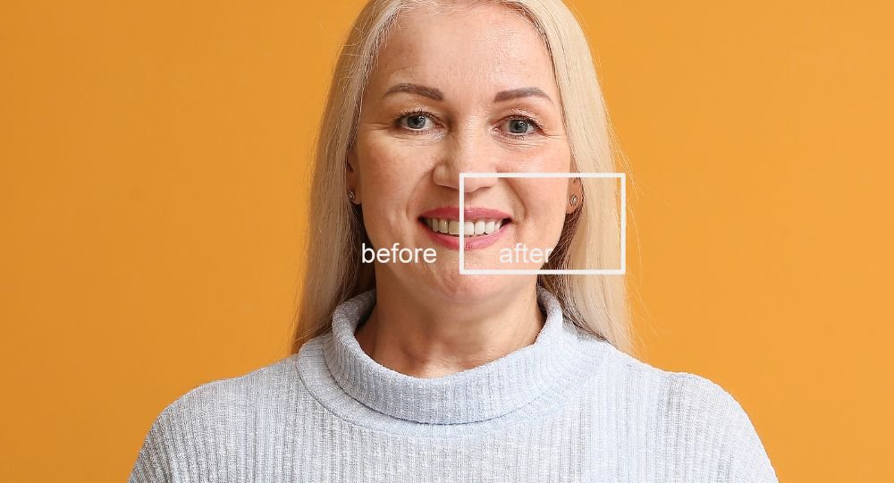 Top Plastic Surgeons USA | What Questions Should I Ask a Plastic Surgeon About a Mommy Makeover? Mommy Makeover