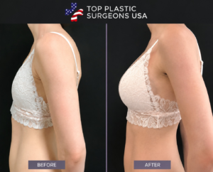 dr. Joseph R results