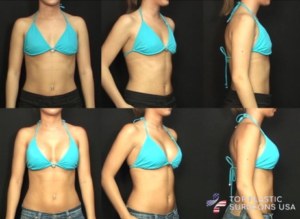 Dr. Jean results